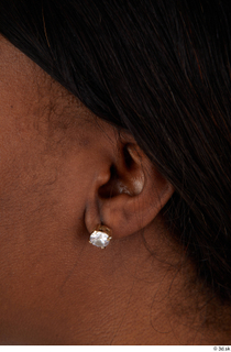 Photos of Dina Moses ear 0001.jpg